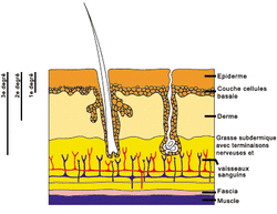 Fig. 1 : Stades de gravité